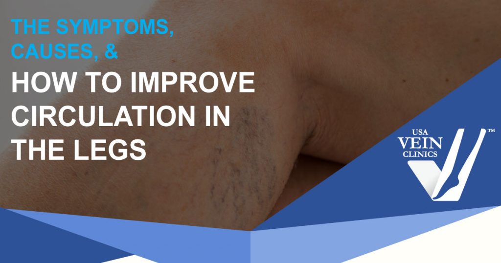 Leg with visible veins: "Symptoms, causes, & how to improve circulation in the legs."