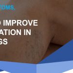 Leg with visible veins: "Symptoms, causes, & how to improve circulation in the legs."