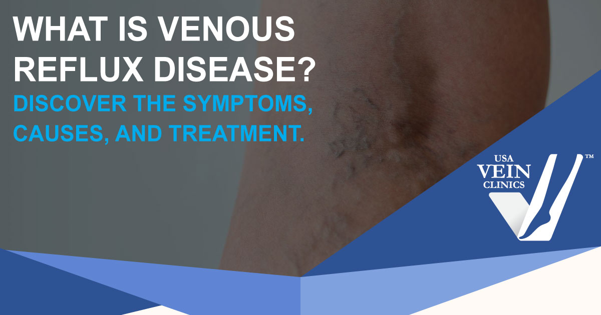 Close up of visible leg veins with words "What is venous reflux disease?"
