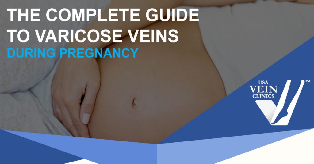 Close up of a pregnant woman's belly: guide to varicose veins and pregnancy.