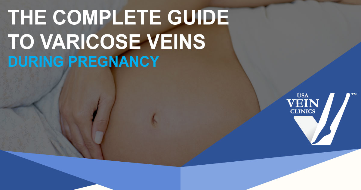 Close up of a pregnant woman's belly: guide to varicose veins and pregnancy.