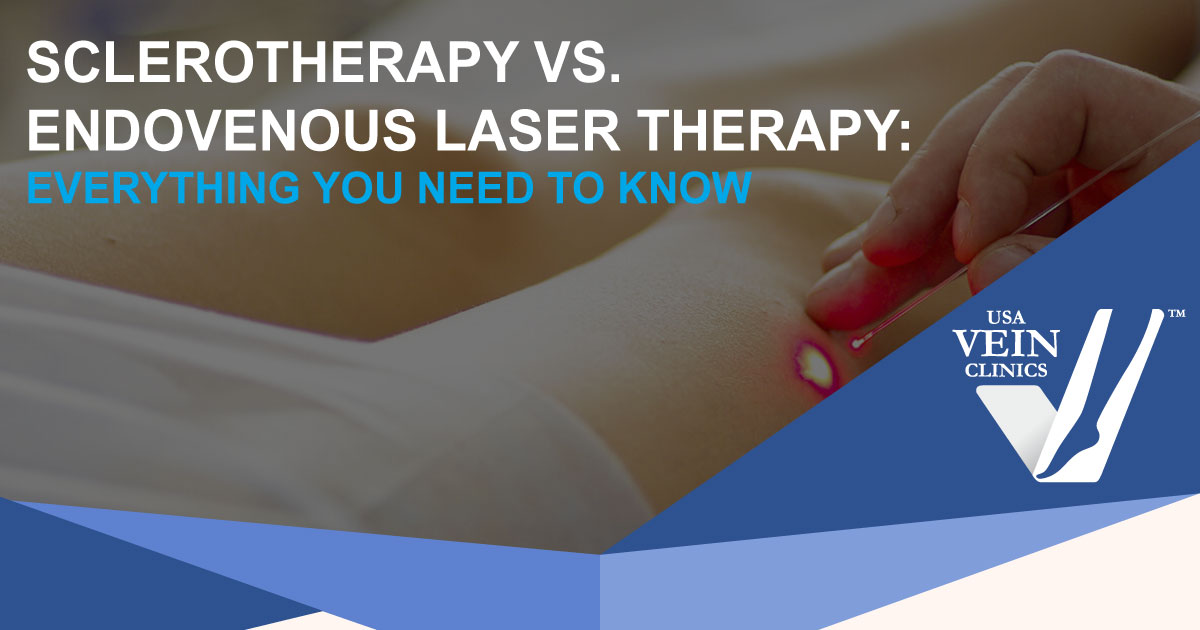 Doctor examining someone's leg with words "Sclerotherapy vs. Endovenous Laser Therapy"