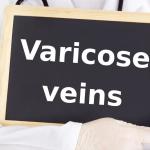 Image of a doctor holding a sign that reads "varicose veins." This image is representing how this article is a guide to understanding varicose veins.