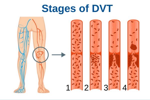 Vein Anatomy