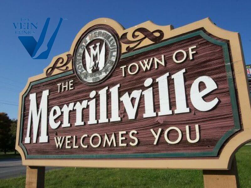 Wooden sign that says "the town of Merrillville welcomes you" where USA Vein Clinics has a location.