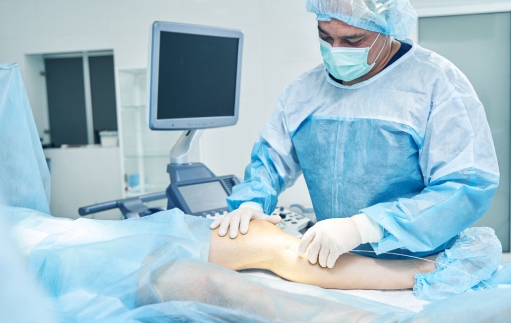 SCLEROTHERAPY VS. ENDOVENOUS LASER THERAPY