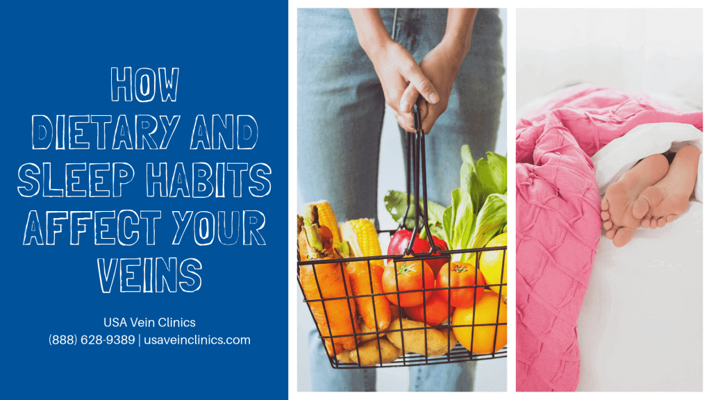 A women in bed to the right, in the middle person holding basket of produce, and to the left "How dietary and sleep habits affect your veins."