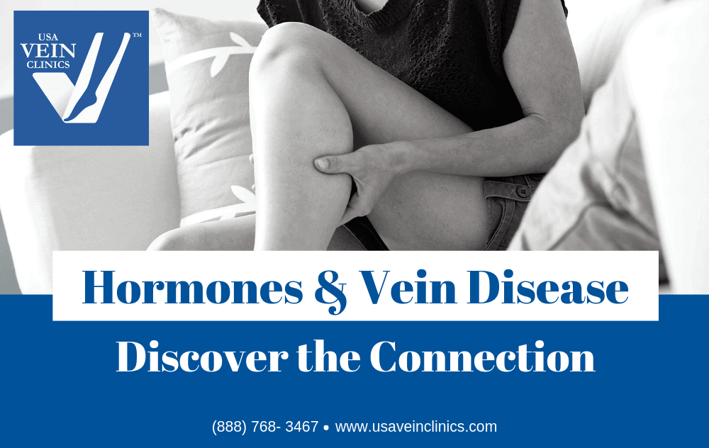 Woman on a chaise holding her leg and words "hormones and vein disease: discover the connection."