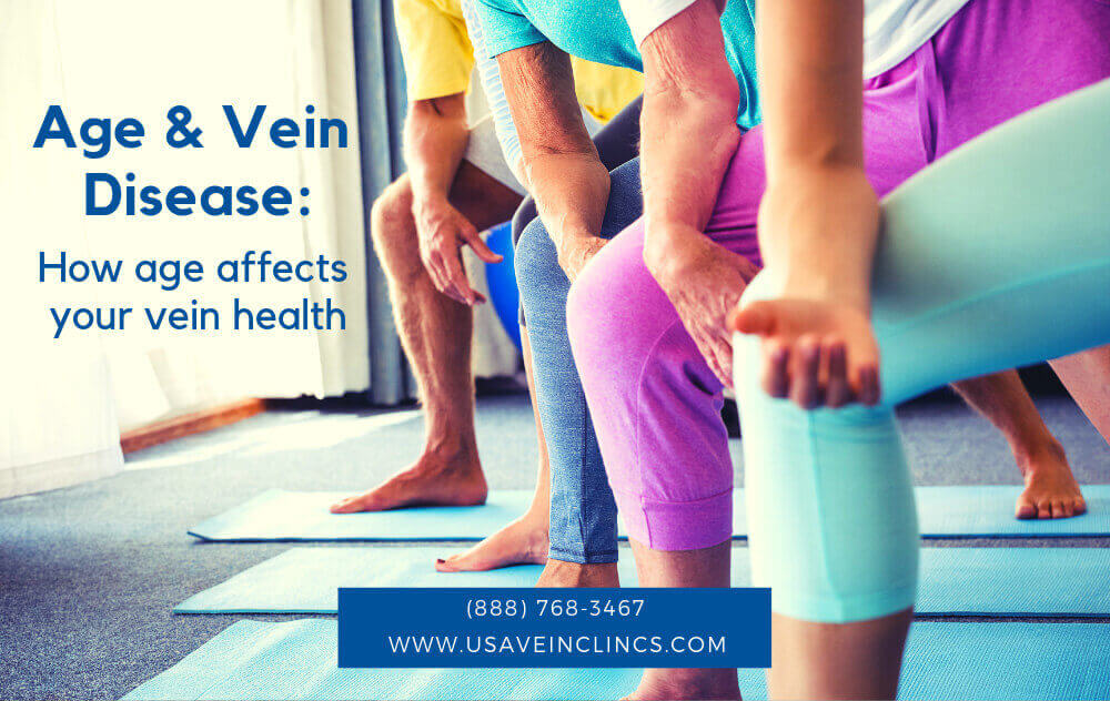 A group of people doing yoga--closed up on their legs--with words "How age affects your vein health."