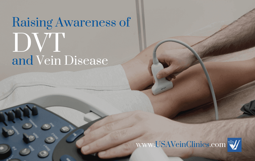 Doctor doing an ultrasound on a leg vein for deep vein thrombosis (DVT) treatment.