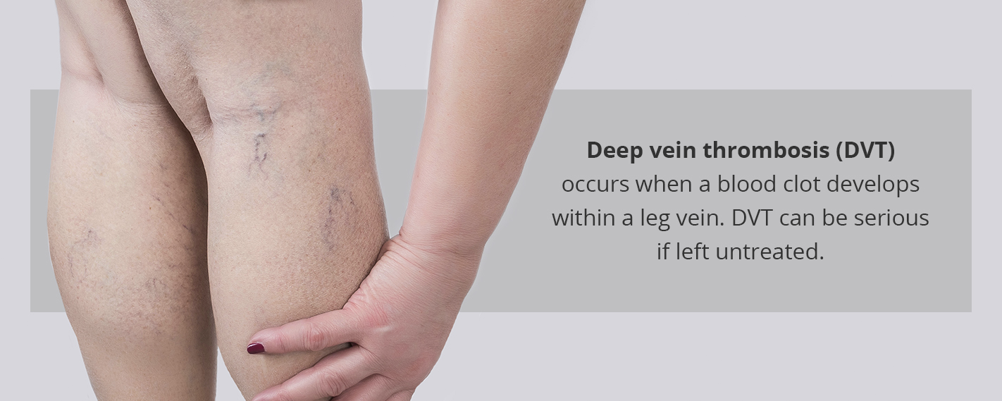 History of Vein Therapy: Where is Was & How It's Improved