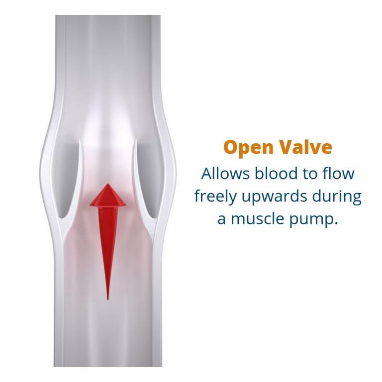 What are Valves in Veins and What is the Function?