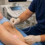 5 Reasons To Choose Laser Therapy For Veins 6 Patient doing EVLT aftter understanding the benefits