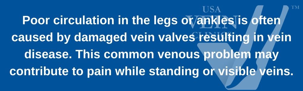 Standing and Varicose Veins