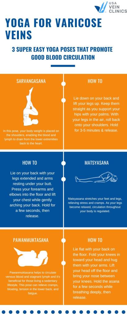 Yoga for varicose veins