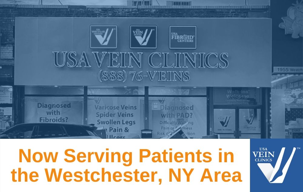 vein clinic in Westchester NY