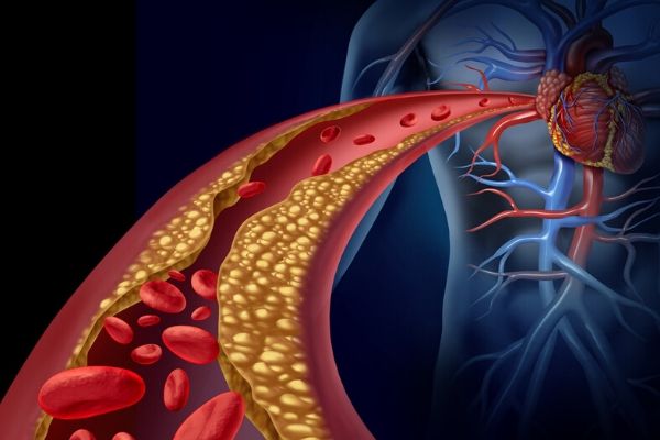 How Many Veins Are in the Human Body? | USA Vein Clinics