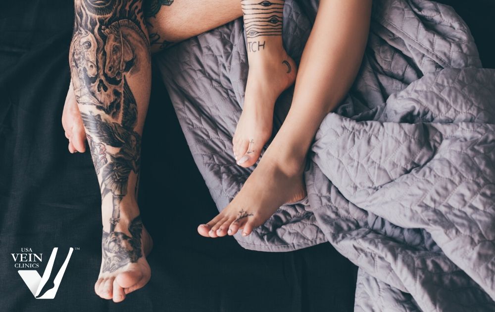 Can You Tattoo Over Varicose Veins? 