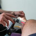 EVLT over Varicose Vein Surgery