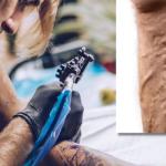 can you tattoo over varicose veins