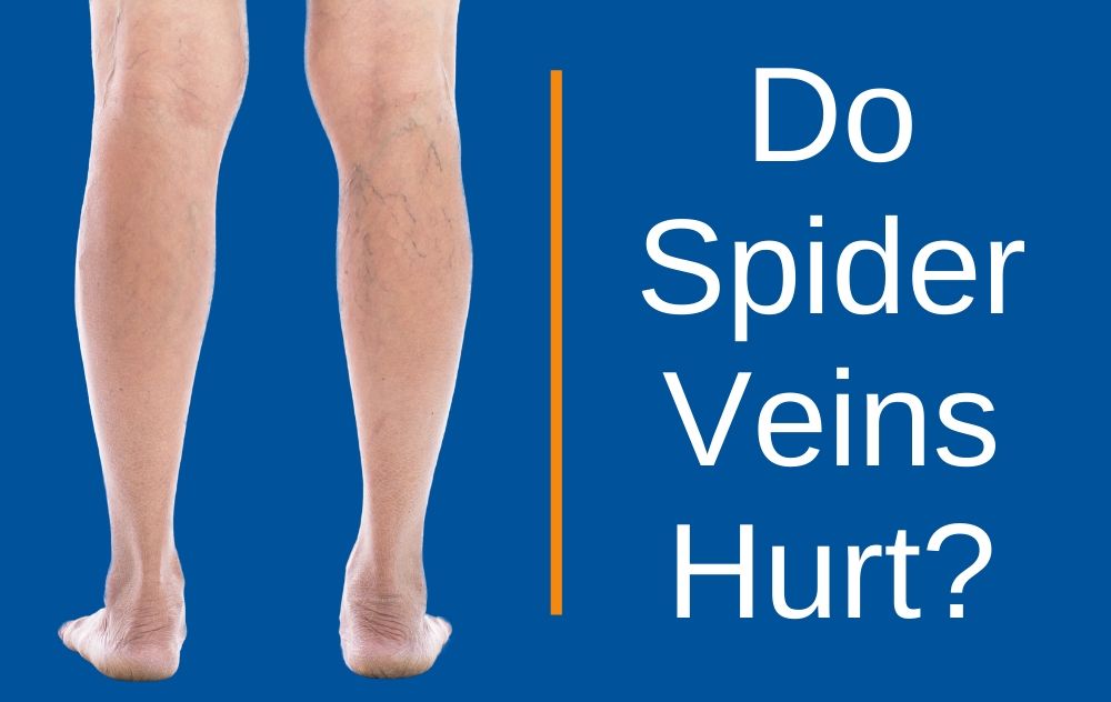Vein Disease Symptoms Archives USA Vein Clinics