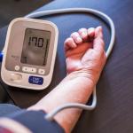 Check blood pressure to see if varicose veins cause high blood pressure