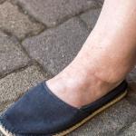 9 Causes of Ankle Swelling