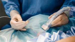 Addressing Vein Issues Beyond Weight Loss