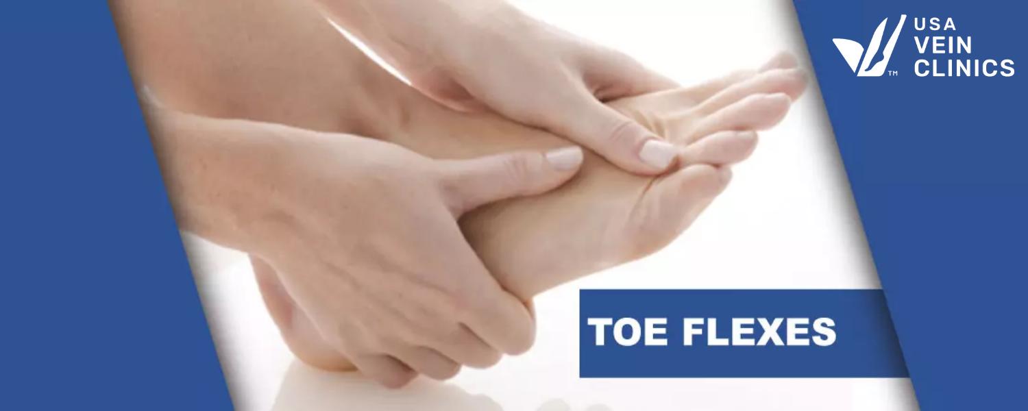 toe flexes as an exercise for varicose veins and spider veins
