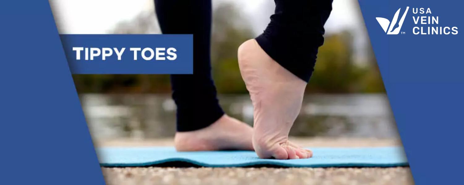 tippy toes as an exercise for varicose veins and spider veins