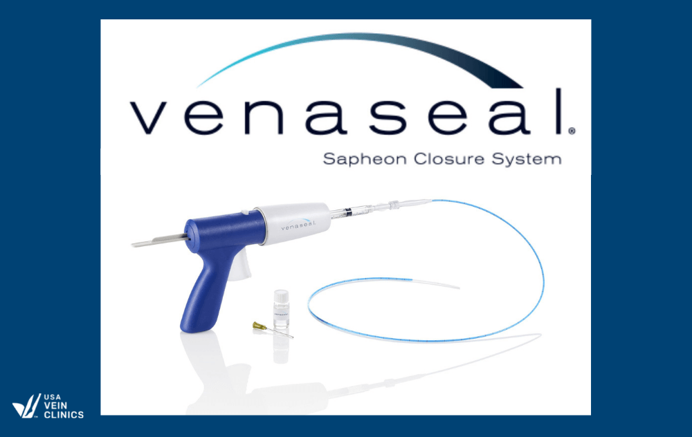 VenaSeal™ Closure System Treatment