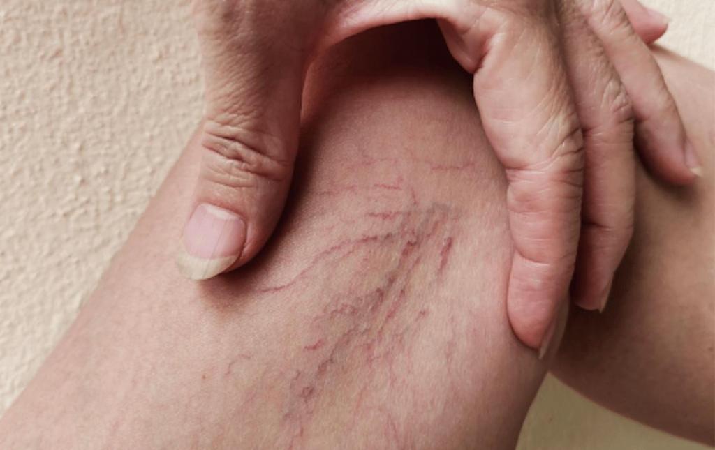 How Many Veins Are in the Human Body