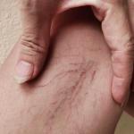 How Many Veins Are in the Human Body