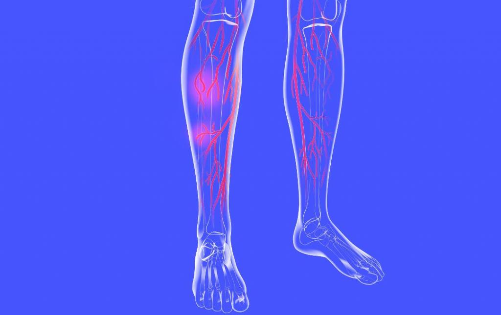greater saphenous vein