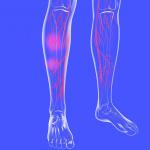 greater saphenous vein