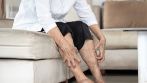 What Do Itchy Veins Feel Like?