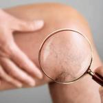 What’s The Difference Between Superficial Veins and Deep Veins