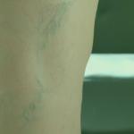 Green Veins