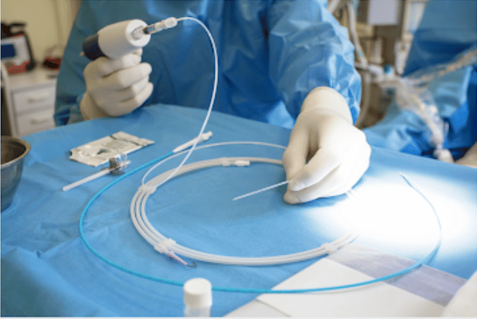 Guide to the Vein Ablation Procedure for Varicose Veins