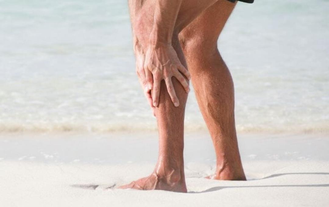 Varicose Veins while Traveling