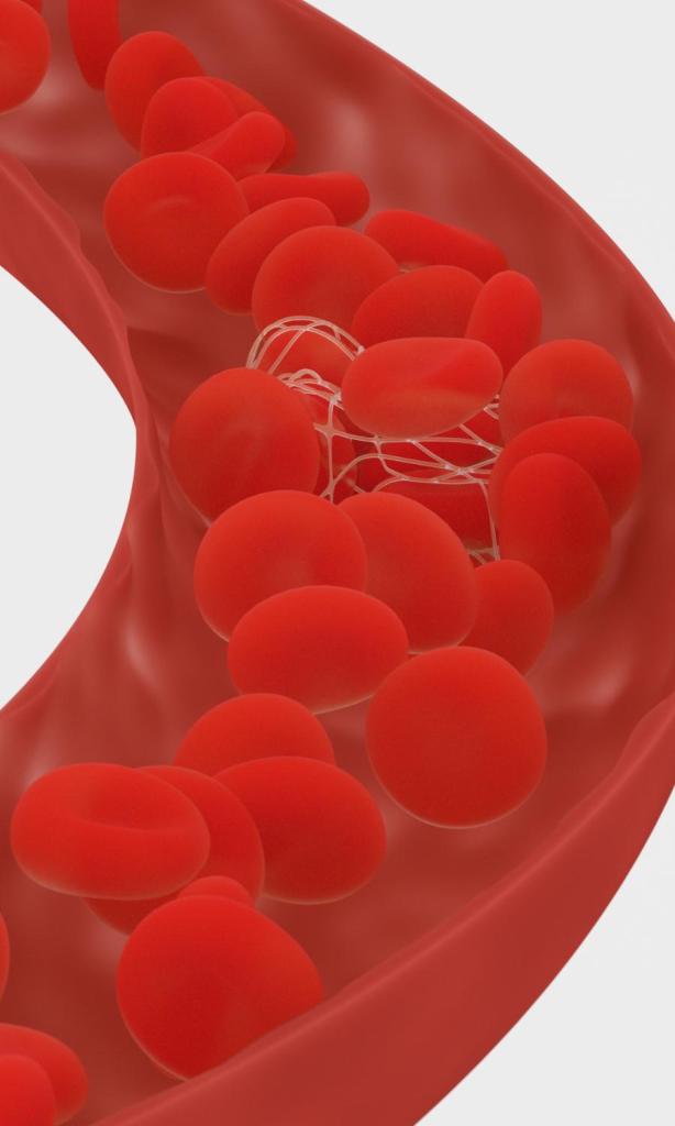 Prevent Blood Clots While Traveling Tips And Tricks