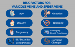 Risk factors for varicose veins and spider veins
