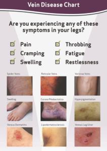 Vein treatment