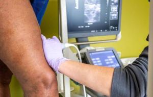 Vein Mapping Treatment