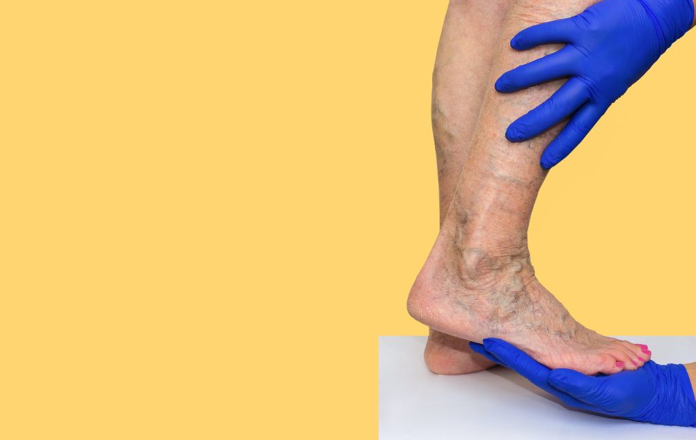 What Are Vein Valves