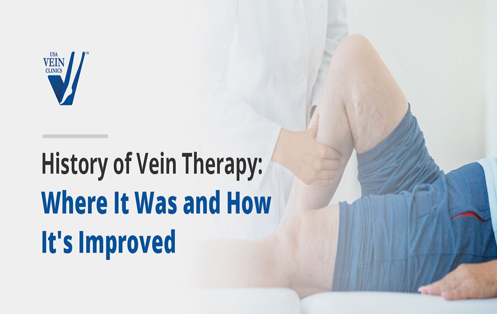 History of Vein Therapy: Where is Was & How It's Improved