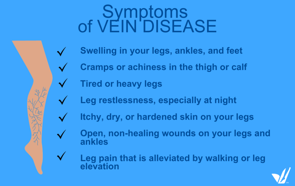Vein disease symptoms