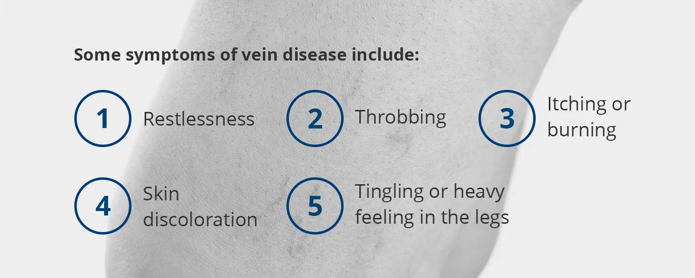 History of Vein Therapy: Where is Was & How It's Improved