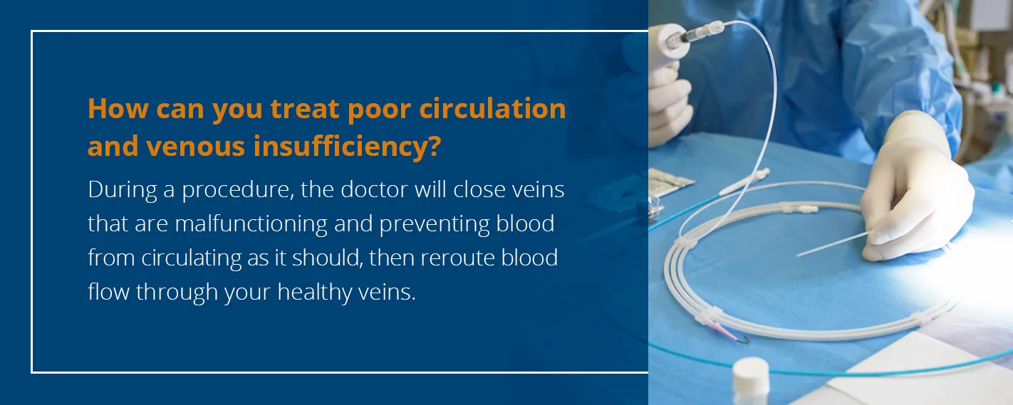 History of Vein Therapy: Where is Was & How It's Improved