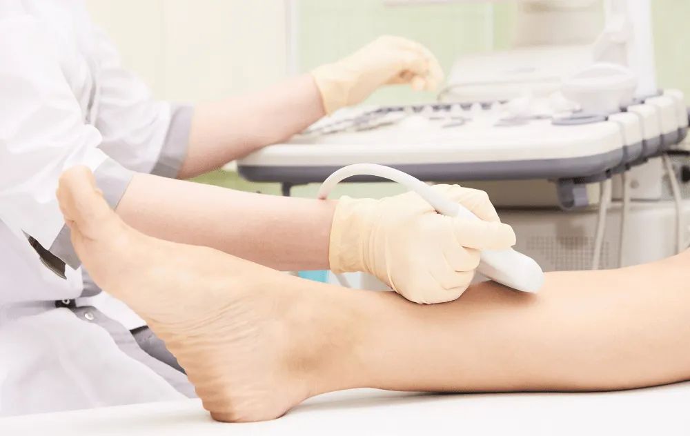 Varicose Veins Leg Ultrasound